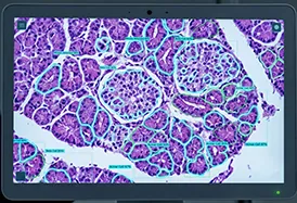 Custom Bioimage Analysis Software Development: Automating High-Content Screening